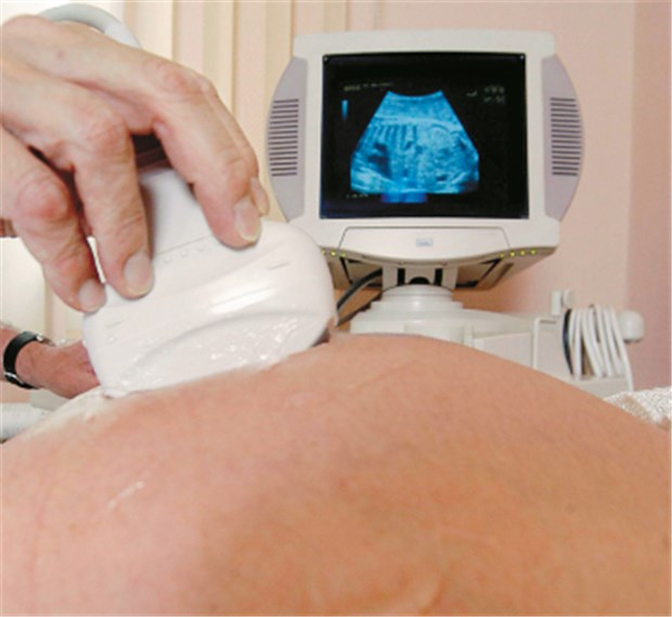 Gesetzgeber verordnet vor Spätabbrüchen drei Tage Bedenkzeit, die Leben retten soll Ultraschalluntersuchung: Gute Hoffnung, die in Verzweiflung umschlagen kann: Ärzte müssen künftig intensiver Schwangere beraten.