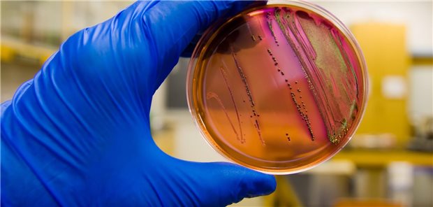 Um 20 Prozent soll der Verbrauch von Antibiotika bis 2030 sinken, um die Bedrohung durch AMR zu senken. Ein Bericht des Europäischen Zentrums für die Prävention und die Kontrolle von Krankheiten (ECDC) fällt ernüchternd aus.