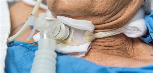 Um Potenzialerhebungen bei trachealkanülierten Patienten vorzunehmen, gibt es flächendeckend noch zu wenig qualifizierte Ärzte und Ärztinnen.