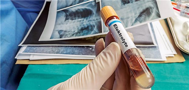 Pseudo-Bartter-Syndrom bei Mukoviszidose.