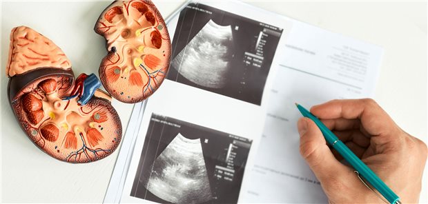 Unklarer Befund bei der Nieren-Sono? Wie geht es mit der Diagnostik weiter?