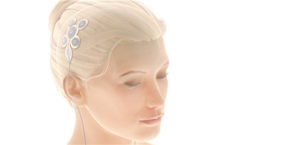 Individuelle Hirnstimulation für Epileptiker
