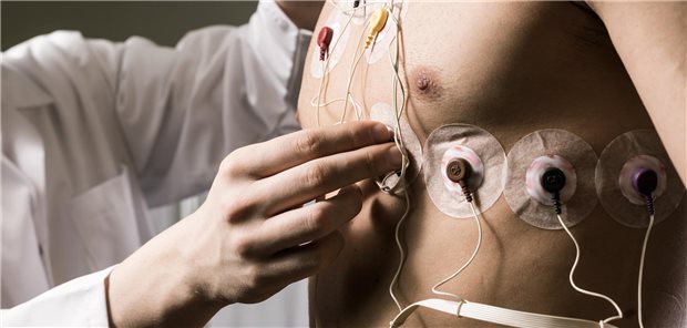 „Unsere Ergebnisse ziehen die herkömmliche Ansicht in Zweifel, wonach das Belastungs-EKG eine hohe Rate falsch positiver Befunde produziert“, bilanzieren die Studienautoren. (Symbolbild)