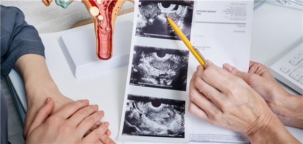 IGeL: Ersatzkassen warnen vor „Geschäften mit der Angst“ Unter anderem in der Kritik: Sonografie der Ovarien.
