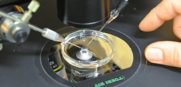 Für Millionen begann das Leben in der Petrischale Unter dem Mikroskop wird ein Spermium in eine Eizelle injiziert, eine spezielle Form der assistierten Reproduktion.