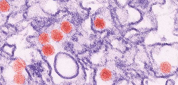Viren finden sich im Gehirn toter Babys mit Mikrozephalie Unterm Elektronenmikroskop: Zika-Viren (rot) im Gewebe.