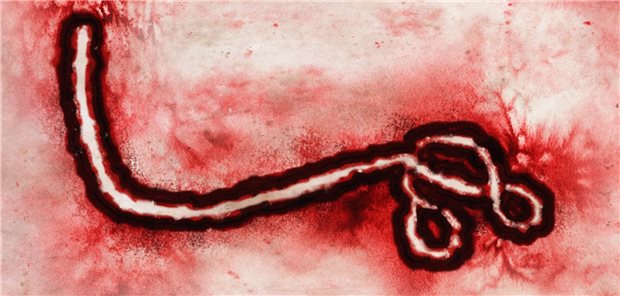 Unterm Mikroskop lässt sich das Ebolavirus ob seiner typischen Fadenform gut erkennen.&#xA;