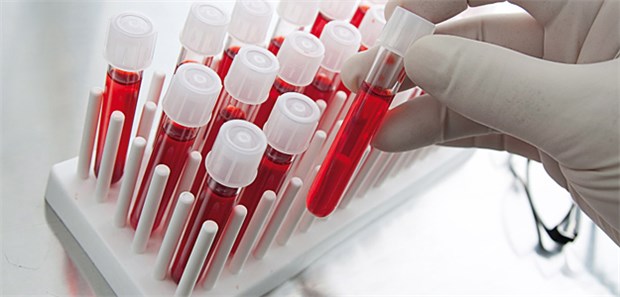 Ritterschlag für Ezetimib zum 'evidenzbasierten' Lipidsenker Untersuchung von Blut auf Cholesterin im Labor.