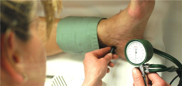 Untersuchung zum Knöchel-Arm-Index: Ein ABI unter 0,9 ist beweisend für eine PAVK. Bei ABI unter 0,7 sowie systolischen Zehendrücken unter 40 mmHg und systolischen Knöcheldrücken unter 70 mmHg sollten Gefäßmediziner konsultiert werden. Denn dann steigt die Gefahr für eine Fußläsion.