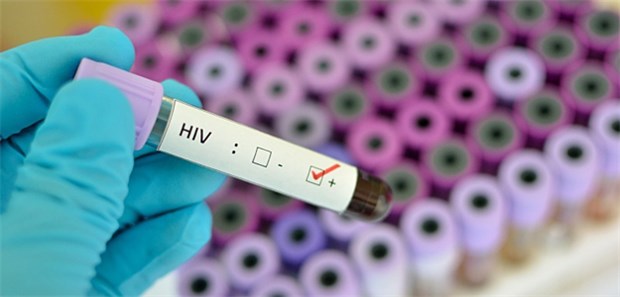 Tausende in Europa wissen nichts von HIV-Infektion Unwissend infiziert: Tausende Menschen in Europa wissen nicht, dass sie den HI-Virus in sich tragen.
