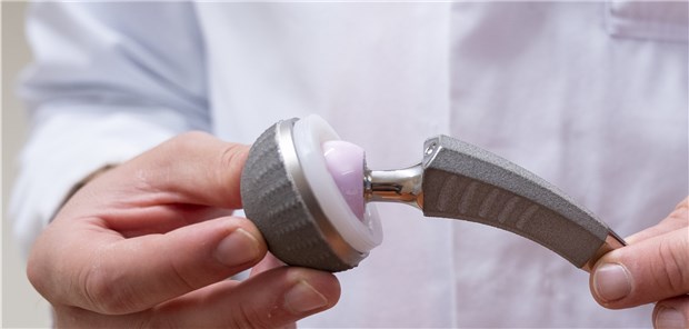 Unzureichend reguliert? Ein Arzt zeigt ein Hüftimplantat. Das Zulassungsverfahren für Medizinprodukte unterscheidet sich von dem für Arzneimittel.