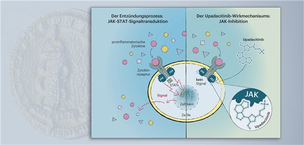 Upadacitinib bindet passgenau im aktiven Zentrum der Januskinasen, wodurch die Signalübertragung ins Zellinnere gehemmt wird. Dadurch werden weniger proinflammatorische Zytokine gebildet, und die Entzündung geht zurück.