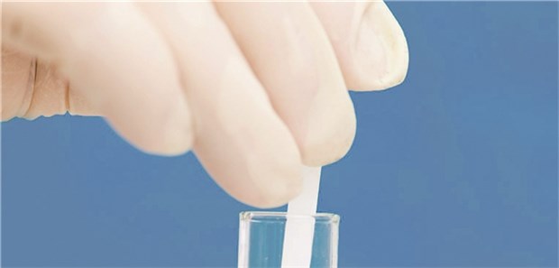 Urin eines asymptomatischen Patienten im Test: Der Nutzen einer Antibiotikatherapie im Falle einer Bakteriurie ist umstritten.