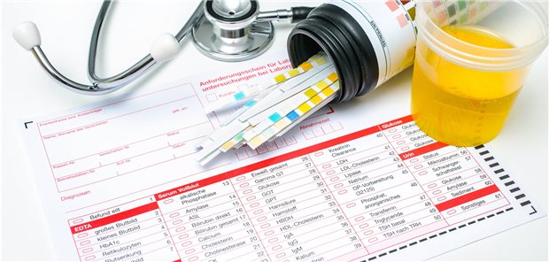Urinprobe: Bei Mikrohämaturie steht der Wert einer weiterführenden Diagnostik in Zweifel.