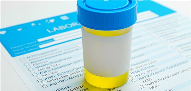Urinprobe: Nephrologen empfehlen, einmal im Jahr die Albumin-Kreatinin-Ratio zu bestimmen, und zwar aus dem morgendlichen Spontanurin.