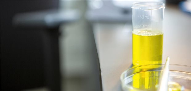 Urinprobe: Oft lassen sich frühe Nierenschäden mit heutiger Labordiagnostik nicht erkennen.
