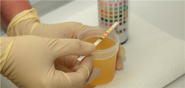 Urinprobe: Werden Bakterien im Urin nachgewiesen, gilt das in vielen Fällen immer noch als therapiebedürftiger Fund – das muss nicht sein.