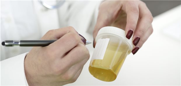 Urintest auf Harnwegsinfektion