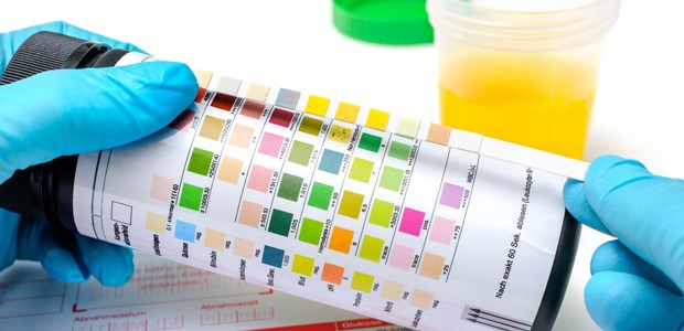 Zucker schützt so gut wie Antibiotikum Urinteststreifen: Der Zucker D-Mannose schützt vor Harnwegsinfekten, zeigt eine Studie.
