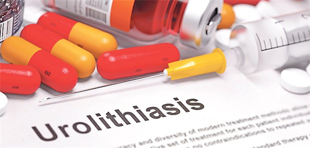 Urolithiasis: Wenn keine Komplikationen vorliegen, reicht meist eine konservative Therapie.