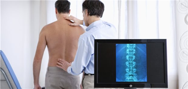 Ursache von Rückenschmerz kann auch ein Tumor sein.