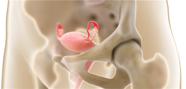 Uterus und Ovarien: Am häufigsten treten Ovarialtumoren zwischen dem 60. und 70. Lebensjahr auf.