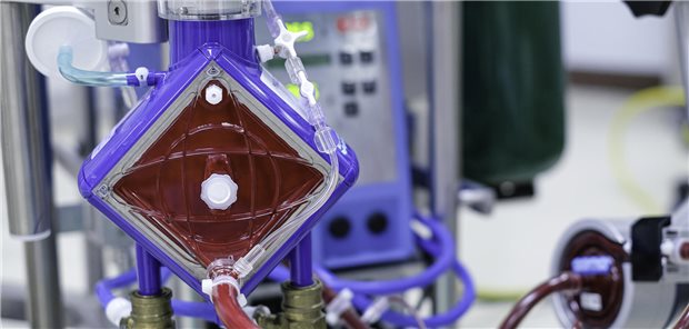 Apparatur einer ECMO