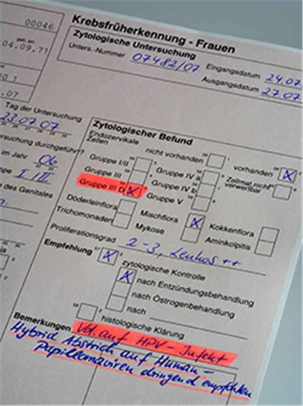 HPV-Impfung schützt langfristig vor Krebsvorstufen Verdacht auf HPV-Infektion: Eine Impfung kann laut Experten "mehr als 80 Prozent aller Zervixkarzinome verhindern".