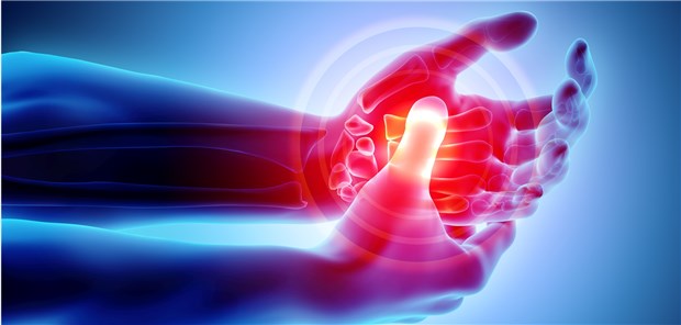 Verdacht auf RA: Ärzte sollten nicht nur auf Sehnen und Gelenke fokussieren, so ein Rheumatologe.