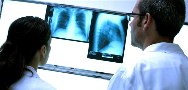 Aufnahmen der Lunge mit Verdacht auf Tuberkulose