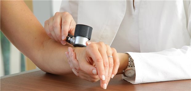 Untersuchung auf Melanoma