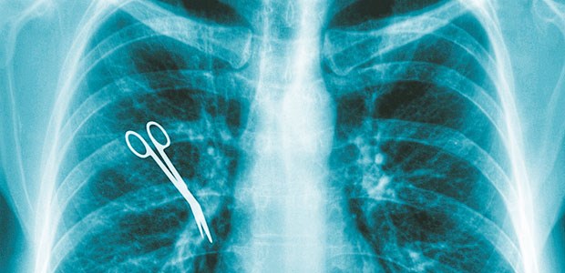 FDP kippt Härtefallfonds Vergessenes OP-Besteck: Röntgenaufnahme eines operierten Patienten.