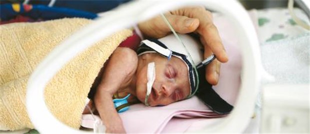 Niedersachsen screent alle Frühchen Verletzlich und klein: Frühgeborenes im Brutkasten eines Kinderkrankenhauses in Hamburg.