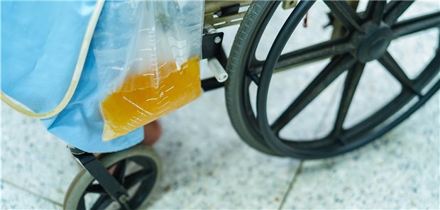 Rollstuhl mit einem Beutel mit tiefgelber Flüssigkeit.