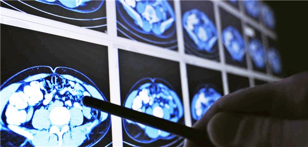 Verstehen Arzt und Patient den Befund, lässt sich meist leichter ein Informed Consent zur Behandlung erzielen und die Adhärenz steigern. Sved Oliver / Stock.adobe.com