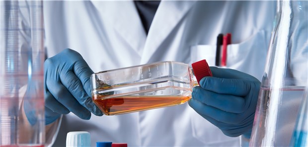 Versuche mit dem Enzym Arginase zeigen, dass es die Arginin-Level im Körper senken kann. Das Ergebnis ist eine verringerte Zahl an Osteoklasten im Knochen.