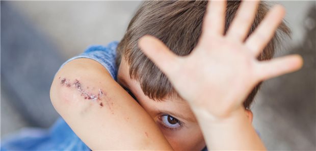 Ein Kind schützt sich mit den Händen vor Gewalt.