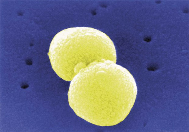 Neue Vakzine gegen Pneumokokken Verursacht die meisten Lungenentzündungen: Streptococcus pneumoniae. Seine Polysaccharidhülle schützt ihn vor dem Immunsystem.