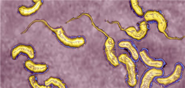 Warnung vor Vibrionen-Infektion beim Baden in Ost- und Nordsee Vibrionen sind Bakterien, die mäßig bis stark salzbedürftig sind (hier zu sehen: Vibrio cholerae).