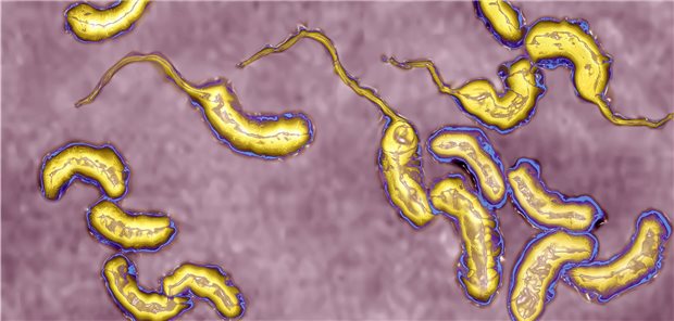 Vibrionen in der Ostsee: Darauf ist zu achten Vibrionen sind Bakterien, die mäßig bis stark salzbedürftig sind (hier zu sehen: Vibrio cholerae).
