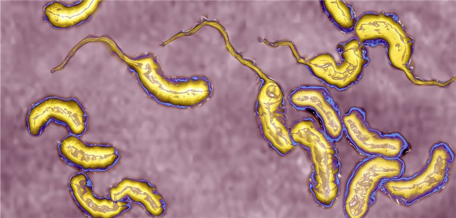 Was Sind Vibrionen In Der Ostsee Vibrionen in der Ostsee: Darauf ist zu achten