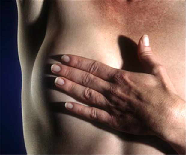 Bei Brustkrebsgen gilt: Nicht verzweifeln, sondern handeln Viele Brustkrebs-Frauen haben eine BRCA-Mutation.