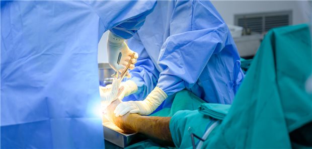 Nahaufnahme eines Orthopäden und dessen Assistententeam, die einen Patienten im Operationssaal des Krankenhauses am Fuß operieren.