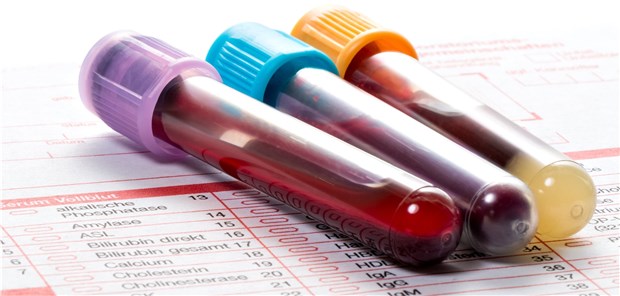 Viele Patienten, viel Stress – und schon ist mal etwas vertauscht. 