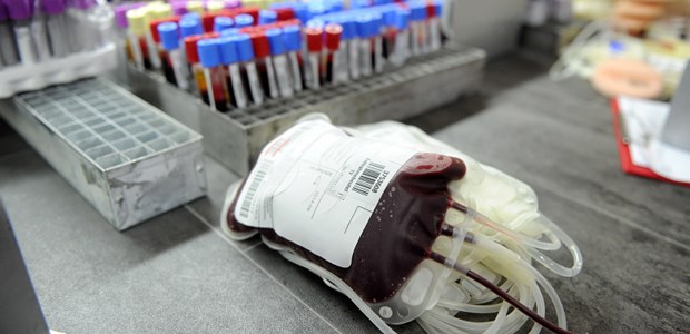 Länder wollen Schwulen Blutspende erlauben Vollblutspende beim Blutspendendienst: Sollen Schwule ebenfalls spenden dürfen?