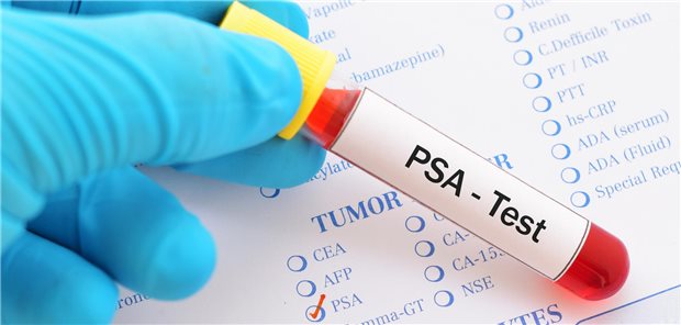 Test mit Aufschrift PSA-Test