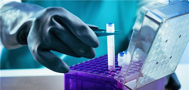 Wissenschafts-Allianz fordert: Öffentliche Förderung nur für akademische Biobanken Von Blut- und Gewebeproben bis hin zu extrahierter DNA: In Biobanken lagert Material für die biomedizinische Grundlagenforschung.