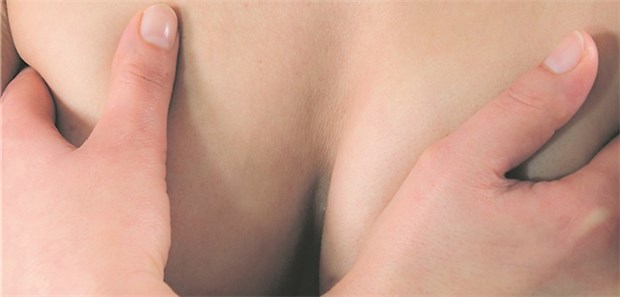 Vorteil durch brusterhaltende Therapie bestätigt Von einer brusterhaltenden Therapie profitierten auch Frauen mit Mamma-Ca im Stadium T1-2, NO-1, die über 50 Jahre alt sind.