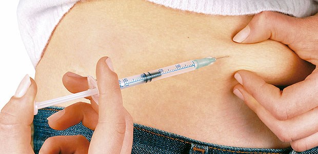 Intensive Insulintherapie zahlt sich langfristig aus Von einer frühen intensivierten Insulintherapie profitieren die Patienten offenbar noch Jahrzehnte danach.