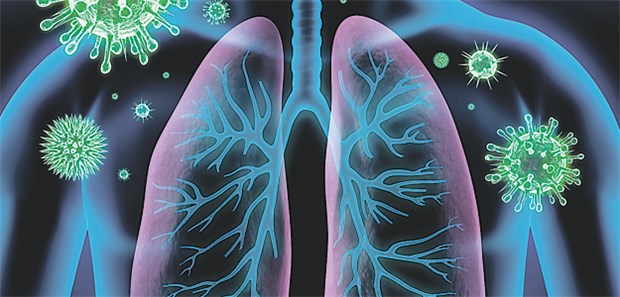 Bei welchen Patienten gibt's Fehldiagnosen? Vor allem ältere Menschen in schlechtem Allgemeinzustand werden fälschlich mit der Diagnose einer ambulant erworbenen Pneumonie (CAP) in ein Krankenhaus aufgenommen.